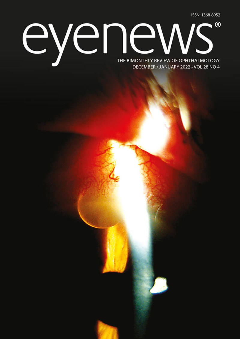 Front-cover-01_EYEDJ22.jpg