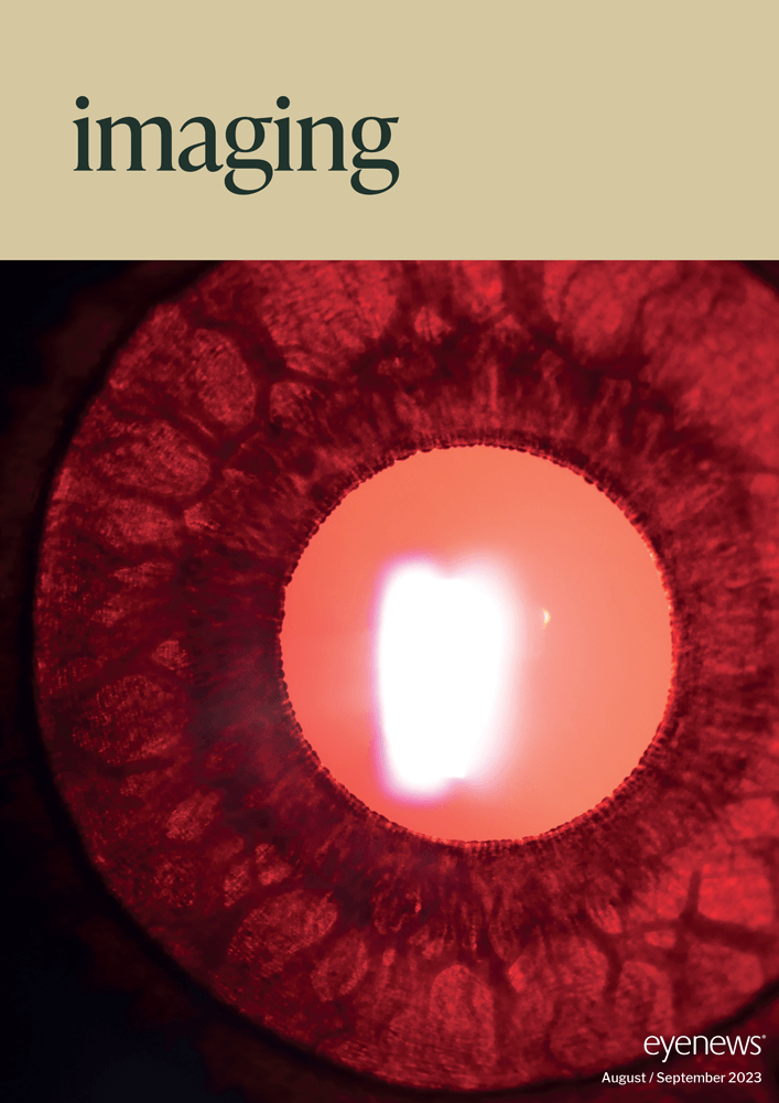 EYE_Imaging_2023_AS23.png