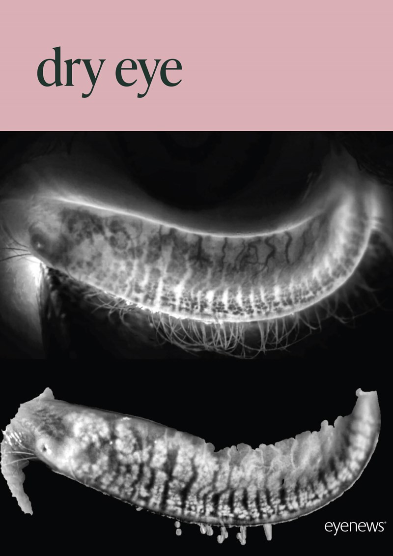 EYE_Dry_Eye_2024_AM24.jpg