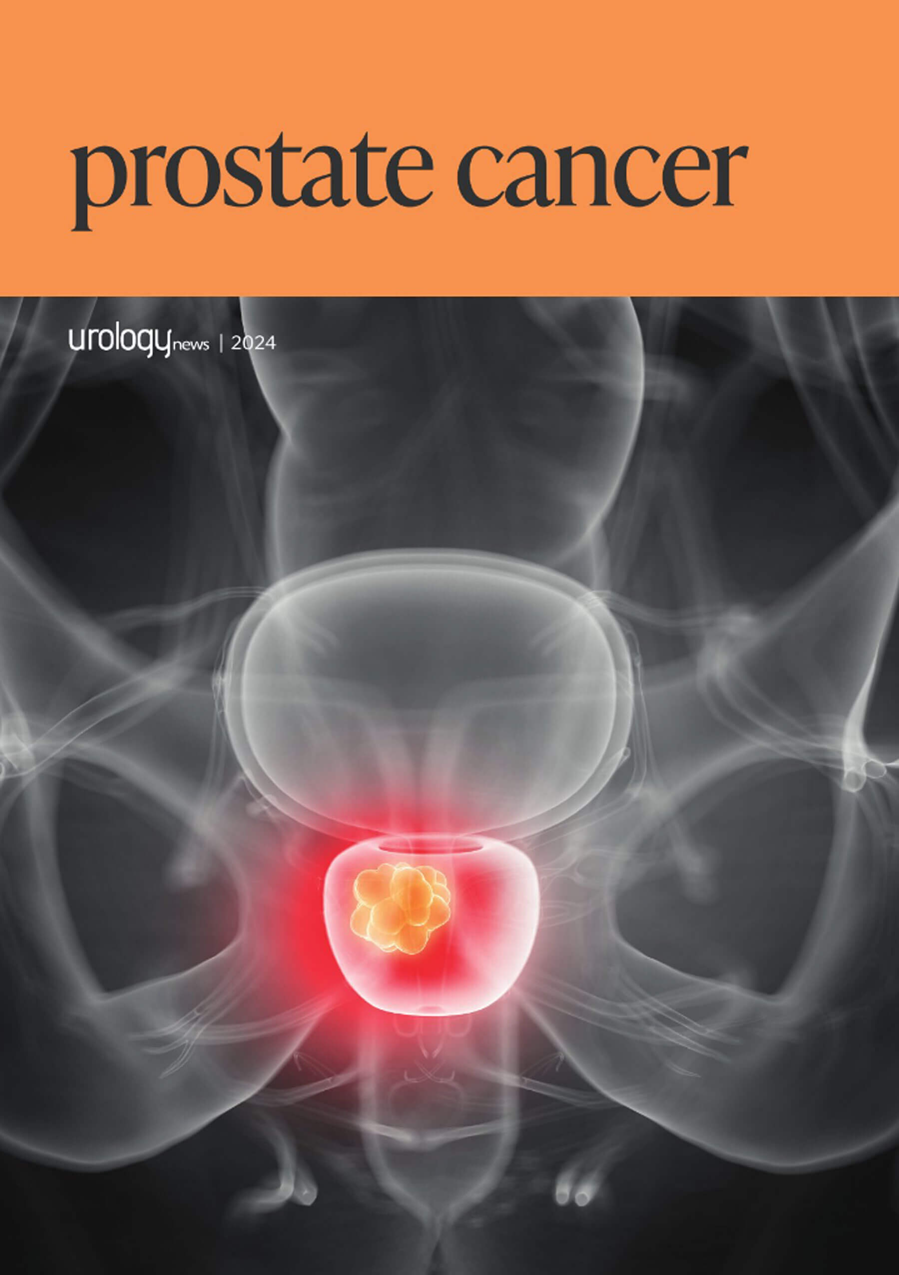 URO MJ24 Prostate-Cancer-2024--front-cover.jpg