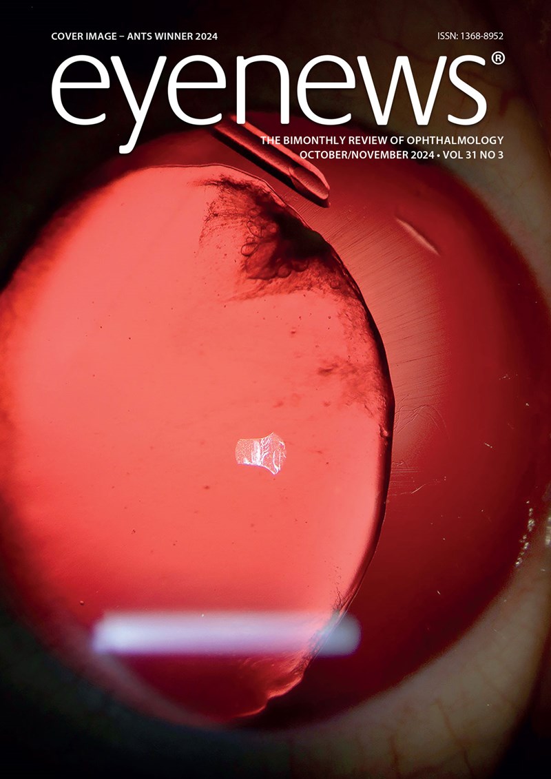 EYE-FRONT-COVER-Vol-31_3_ON24.jpg