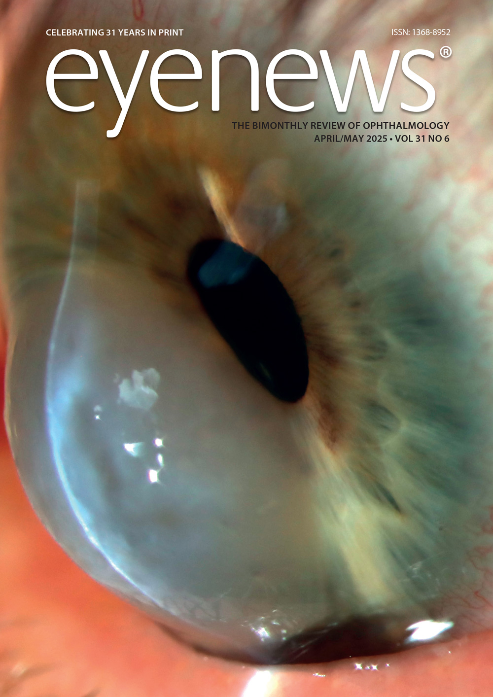 EYE-AM25-FRONT-COVER.jpg