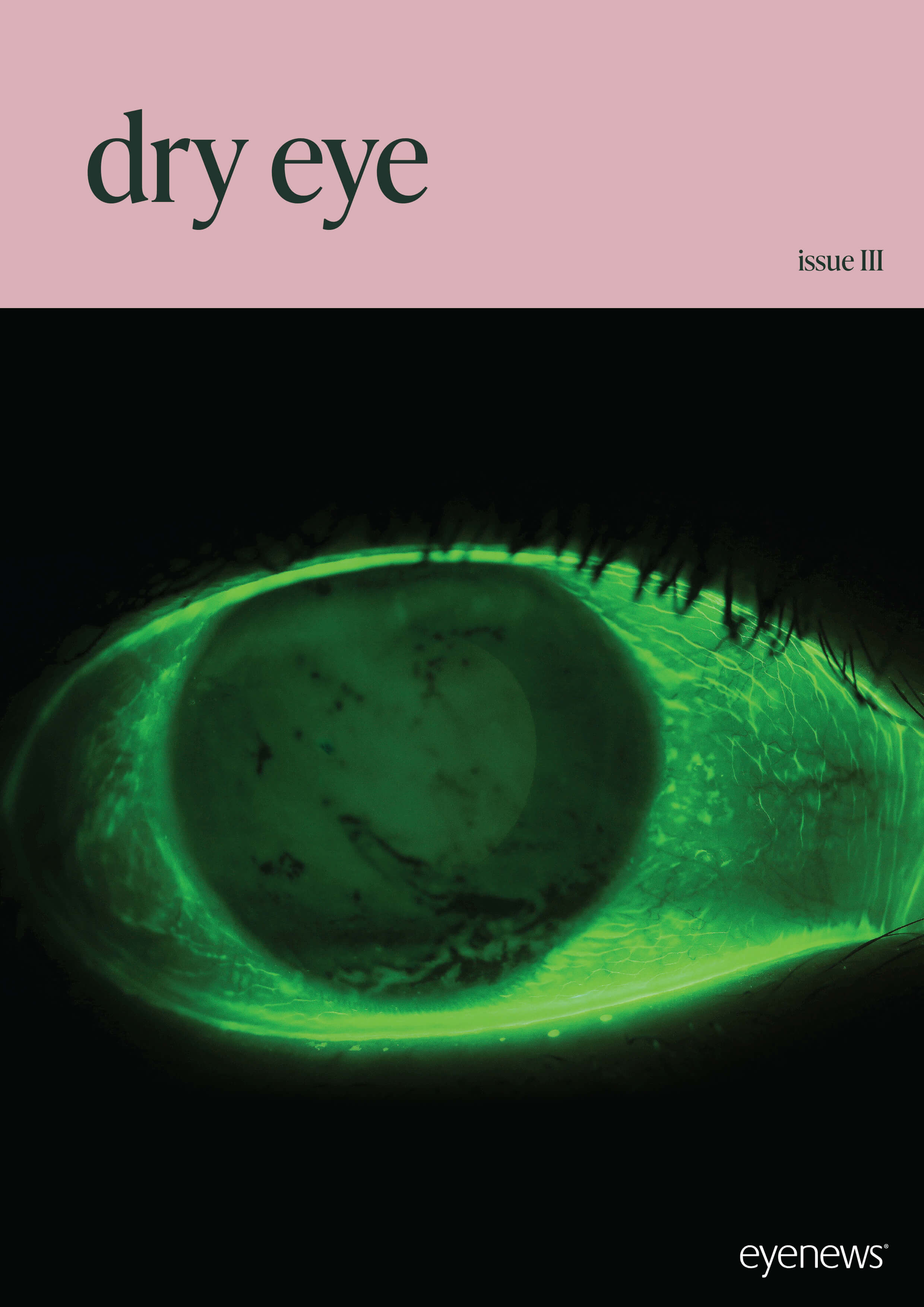 EYE_DryEye_III_AM25.jpg