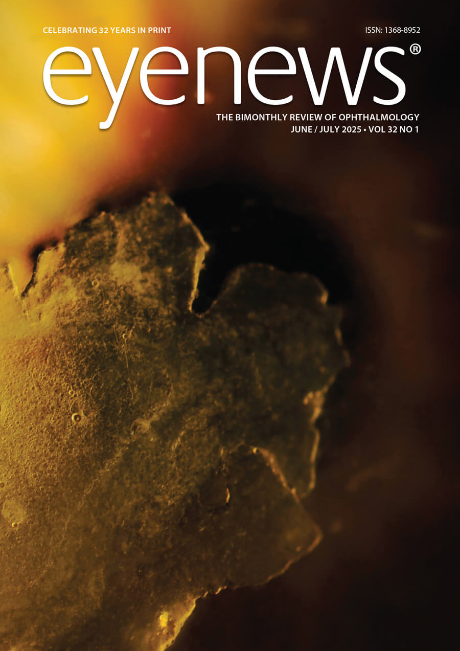 EYEJJ25-FRONT-COVER.jpg