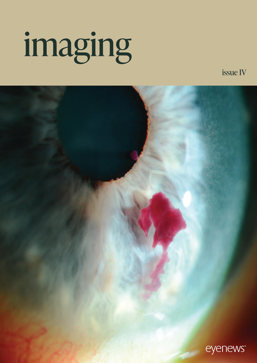 EYE_Imaging_IV_AS25-WEB.jpg