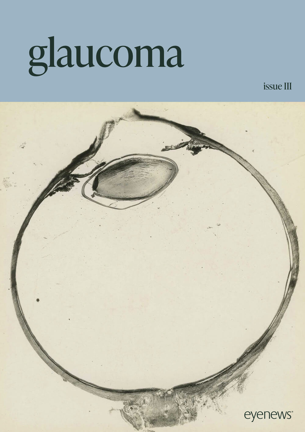 EYEGlaucoma-III-SUPPLEMENT-Cover.jpg