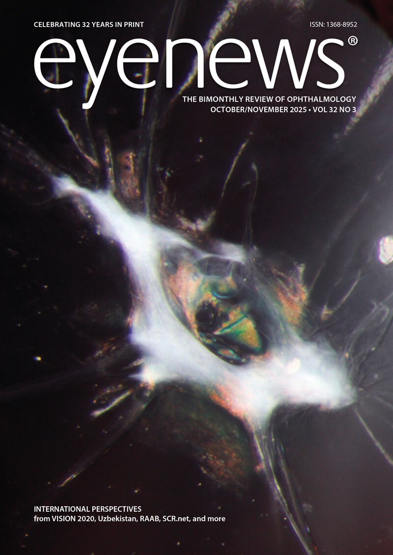 EYEON25-front-cover.jpg